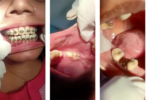 Best Dental Clinic