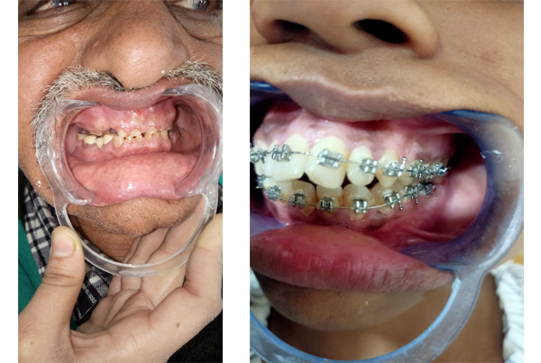 Best Dental Clinic