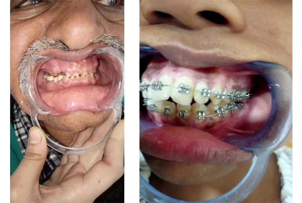 Best Dental Clinic