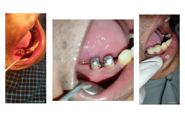 Best Dental Clinic