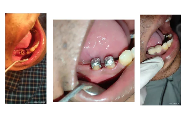 Best Dental Clinic