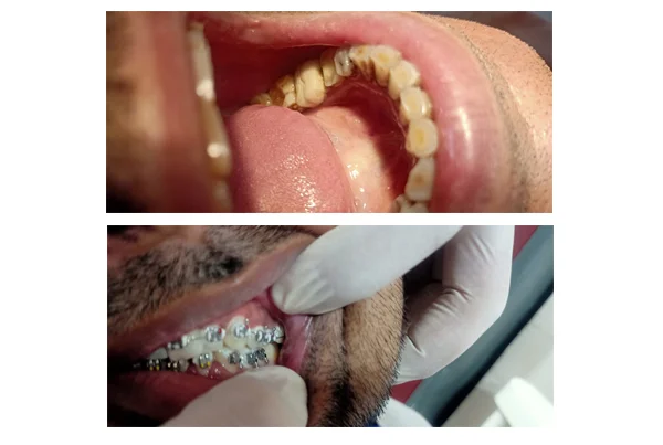 Best Dental Clinic