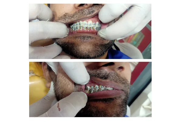 Best Dental Clinic