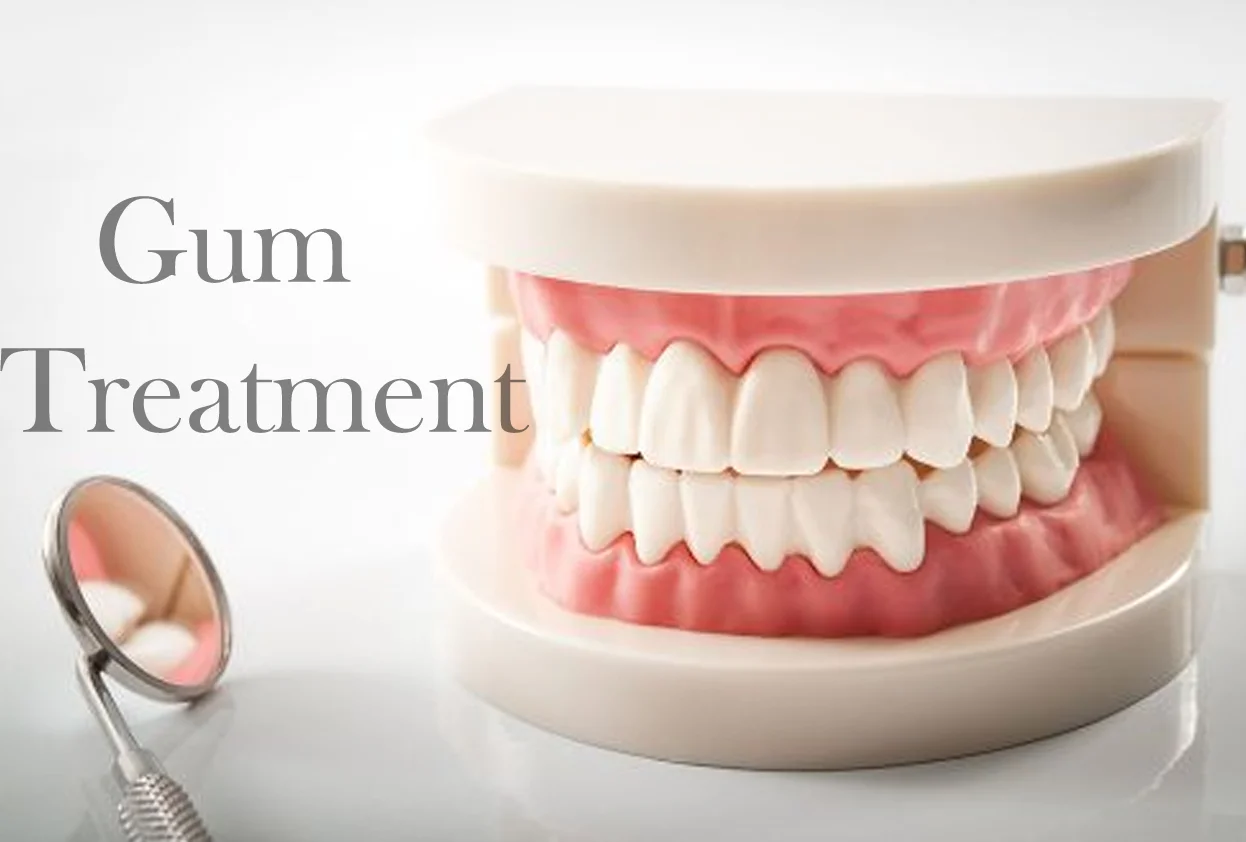 Gum Treatment