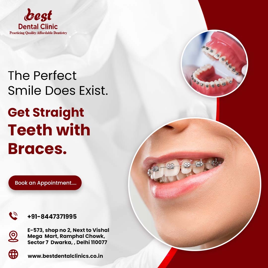 Braces Treatment